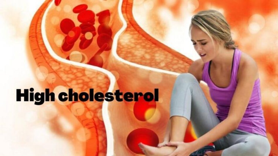 High Cholesterol Foods, Foods For Good Cholesterol,Cholesterol Treatment,